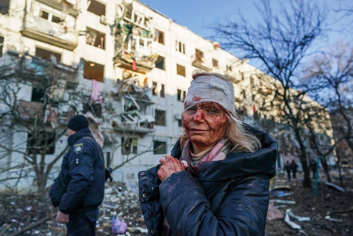 Teacher Olena Kurylo after being wounded in a Russian airstrike on a Kharkiv apartment building, 24th February